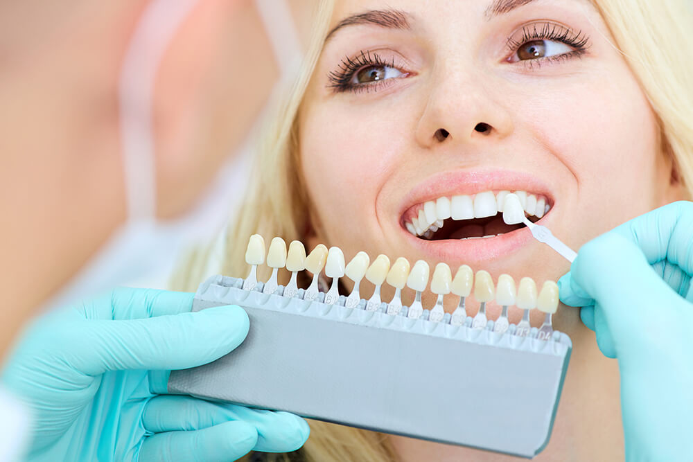Smile Makeover