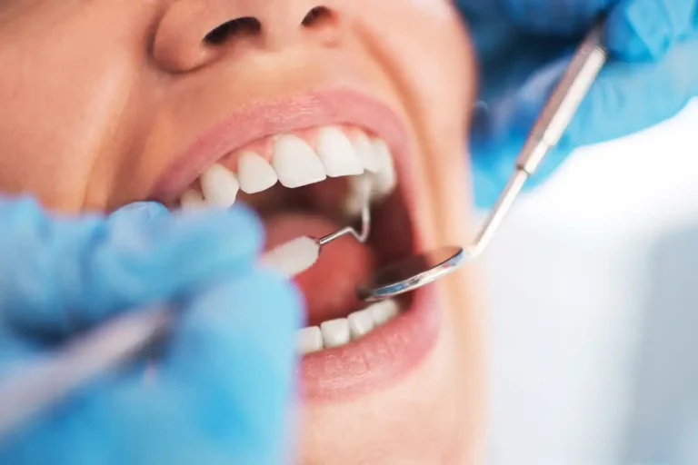 Should You Schedule Dental Treatment Before the Holidays?